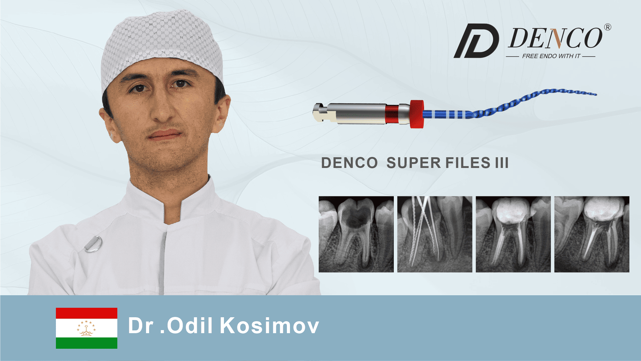 Successful Clinical Case with SUPER fILES III by DENCO