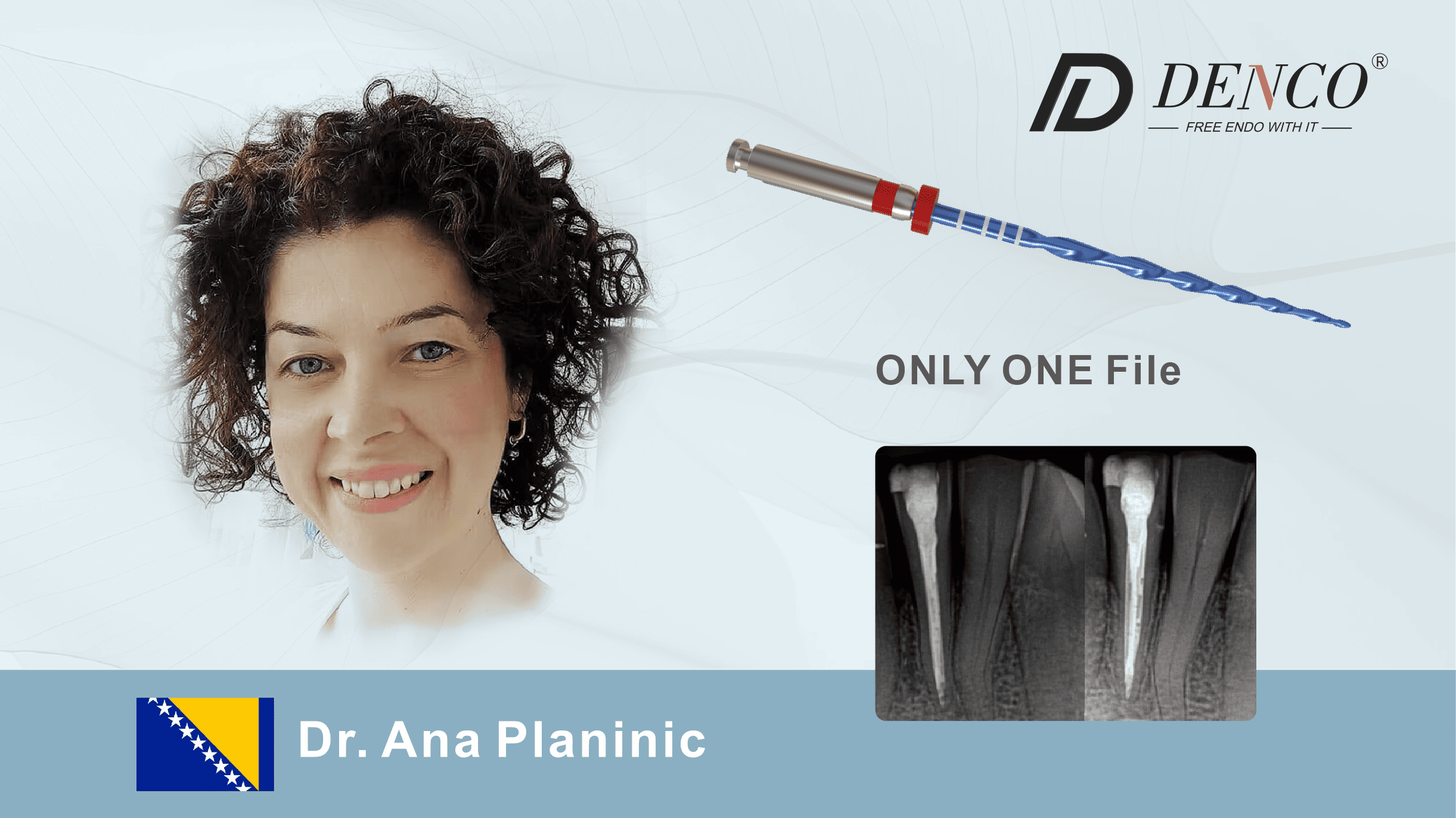 Successful Endodontic Retreatment Using Denco’s Only One File R25